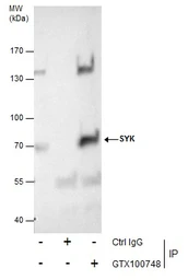 Anti-Syk antibody [N2C2], Internal used in Immunoprecipitation (IP). GTX100748
