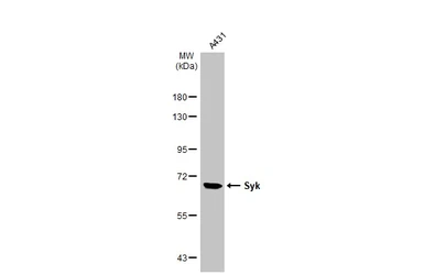 Anti-Syk antibody [N2C2], Internal used in Western Blot (WB). GTX100748