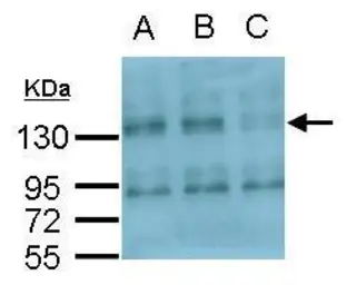 Anti-Integrin alpha V antibody [C2C3], C-term used in Western Blot (WB). GTX100789