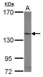 Anti-Integrin alpha V antibody [C2C3], C-term used in Western Blot (WB). GTX100789
