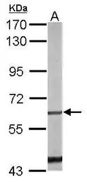 Anti-NUR77 antibody used in Western Blot (WB). GTX100797