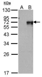Anti-NUR77 antibody used in Western Blot (WB). GTX100797
