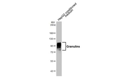 Anti-Granulins antibody used in Western Blot (WB). GTX100803