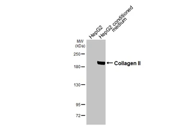Anti-Collagen II antibody [N1], N-term used in Western Blot (WB). GTX100829