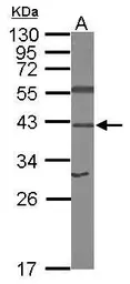 Anti-RPSA antibody [N1C3] used in Western Blot (WB). GTX100831