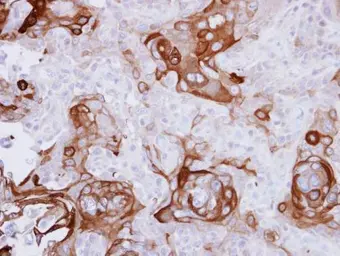 Anti-RPSA antibody [N1C3] used in IHC (Paraffin sections) (IHC-P). GTX100831