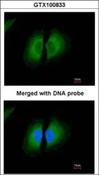 Anti-HMW Kininogen antibody used in Immunocytochemistry/ Immunofluorescence (ICC/IF). GTX100833