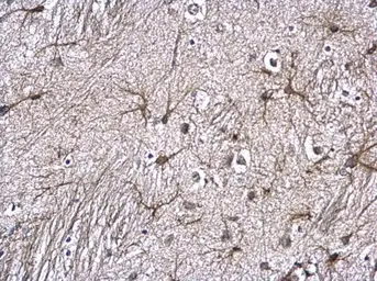 Anti-GFAP antibody used in IHC (Paraffin sections) (IHC-P). GTX100850