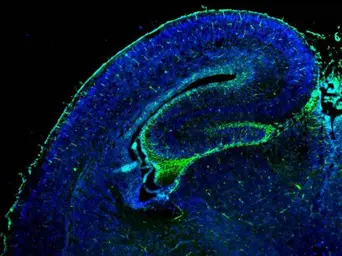 Anti-GFAP antibody used in IHC (Frozen sections) (IHC-Fr). GTX100850