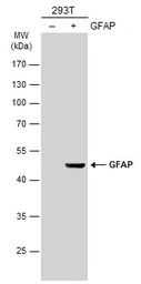 Anti-GFAP antibody used in Western Blot (WB). GTX100850