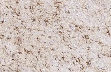 Anti-GFAP antibody used in IHC (Paraffin sections) (IHC-P). GTX100850