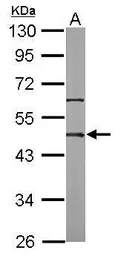 Anti-Oct4 antibody [N2C3] used in Western Blot (WB). GTX100855