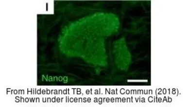 Anti-Nanog antibody [N3C3] used in Immunocytochemistry/ Immunofluorescence (ICC/IF). GTX100863