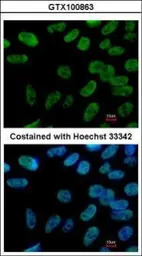 Anti-Nanog antibody [N3C3] used in Immunocytochemistry/ Immunofluorescence (ICC/IF). GTX100863