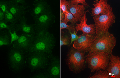 Anti-Nanog antibody [N3C3] used in Immunocytochemistry/ Immunofluorescence (ICC/IF). GTX100863
