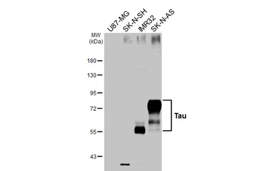 Anti-Tau antibody used in Western Blot (WB). GTX100866