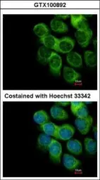 Anti-Thymidine Phosphorylase antibody used in Immunocytochemistry/ Immunofluorescence (ICC/IF). GTX100892