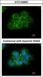 Anti-CRK antibody [N2C3] used in Immunocytochemistry/ Immunofluorescence (ICC/IF). GTX100901