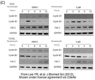 Anti-Cyclin B1 antibody used in Western Blot (WB). GTX100911