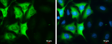 Anti-Cyclin B1 antibody used in Immunocytochemistry/ Immunofluorescence (ICC/IF). GTX100911