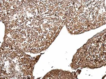 Anti-B-Raf antibody [N2C1], Internal used in IHC (Paraffin sections) (IHC-P). GTX100913
