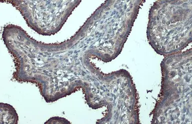Anti-B-Raf antibody [N2C1], Internal used in IHC (Paraffin sections) (IHC-P). GTX100913