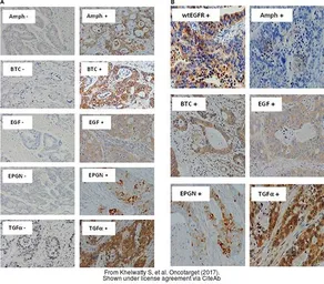 Anti-Amphiregulin antibody used in IHC (Paraffin sections) (IHC-P). GTX100986
