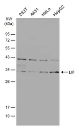 Anti-LIF antibody used in Western Blot (WB). GTX101021