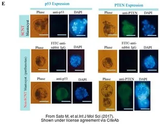 Anti-PTEN antibody used in Immunocytochemistry/ Immunofluorescence (ICC/IF). GTX101025