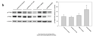 Anti-PTEN antibody used in Western Blot (WB). GTX101025