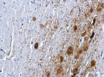 Anti-PTEN antibody used in IHC (Paraffin sections) (IHC-P). GTX101025
