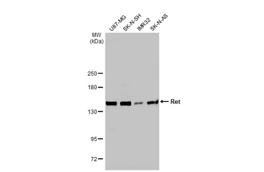 Anti-Ret antibody used in Western Blot (WB). GTX101059