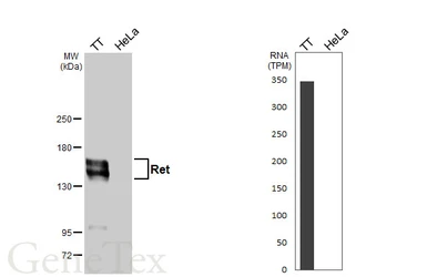 Anti-Ret antibody used in Western Blot (WB). GTX101059