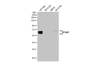 Anti-PSAP antibody [N1N3] used in Western Blot (WB). GTX101064