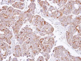 Anti-PSAP antibody [N1N3] used in IHC (Paraffin sections) (IHC-P). GTX101064