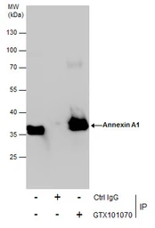 Anti-Annexin A1 antibody used in Immunoprecipitation (IP). GTX101070