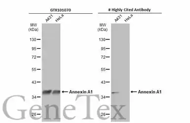 Anti-Annexin A1 antibody used in Western Blot (WB). GTX101070