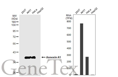 Anti-Annexin A1 antibody used in Western Blot (WB). GTX101070