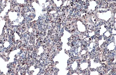 Anti-Annexin A1 antibody used in IHC (Paraffin sections) (IHC-P). GTX101070