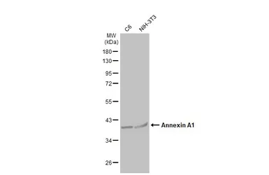 Anti-Annexin A1 antibody used in Western Blot (WB). GTX101070