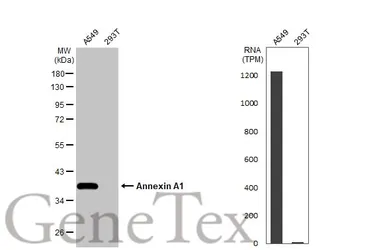 Anti-Annexin A1 antibody used in Western Blot (WB). GTX101070