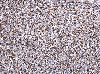 Anti-ZAP70 antibody used in IHC (Paraffin sections) (IHC-P). GTX101076