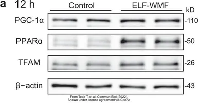 Anti-PPAR alpha antibody used in Western Blot (WB). GTX101098