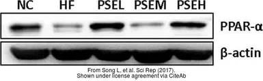 Anti-PPAR alpha antibody used in Western Blot (WB). GTX101098