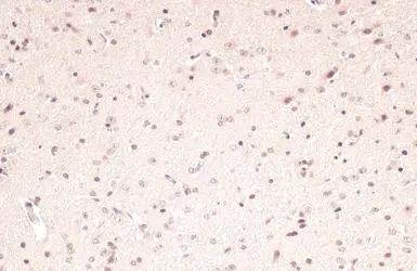 Anti-PPAR alpha antibody used in IHC (Paraffin sections) (IHC-P). GTX101098