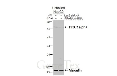 Anti-PPAR alpha antibody used in Western Blot (WB). GTX101098