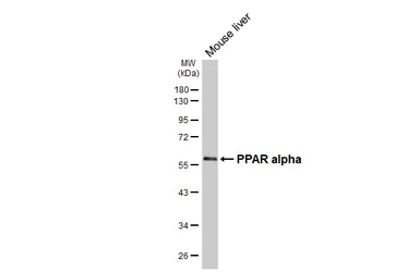 Anti-PPAR alpha antibody used in Western Blot (WB). GTX101098