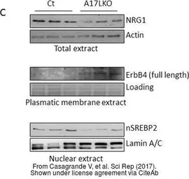 Anti-Neuregulin-1 antibody used in Western Blot (WB). GTX101117