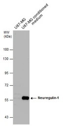 Anti-Neuregulin-1 antibody used in Western Blot (WB). GTX101117