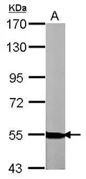 Anti-Neuregulin-1 antibody used in Western Blot (WB). GTX101117